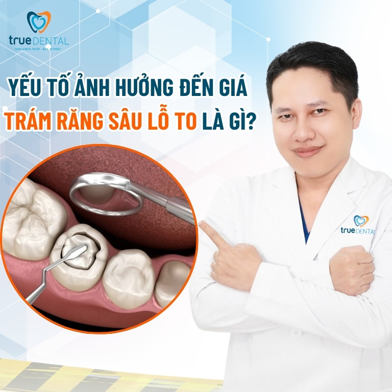 Trám răng sâu lỗ to được không? Giá bao nhiêu? 5 6 yếu tố ảnh hưởng đến giá trám răng sâu lỗ to