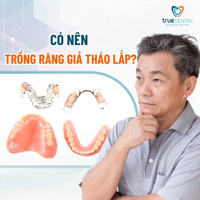 Trồng răng giả tháo lắp là gì? Ưu và nhược điểm 2 Có nên trồng răng giả tháo lắp không?