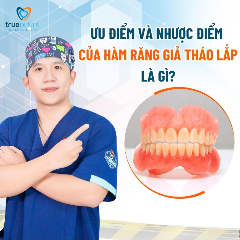 Trồng răng giả tháo lắp là gì? Ưu và nhược điểm 3 Ưu điểm và nhược điểm của hàm răng giả tháo lắp