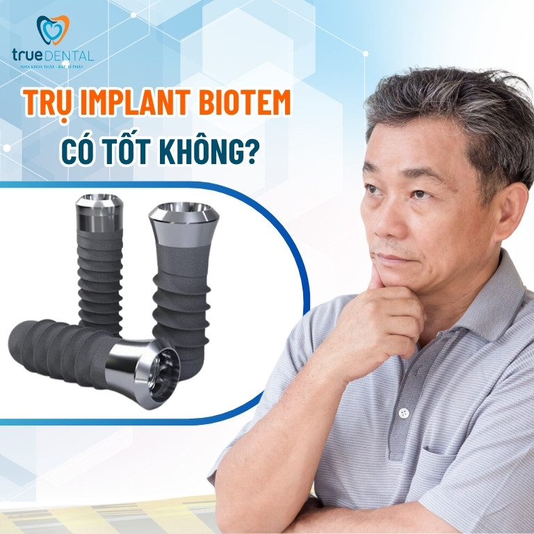 Trụ implant Biotem Hàn Quốc giá bao nhiêu? Có tốt không? 4 Trụ Implant Biotem có tốt không?