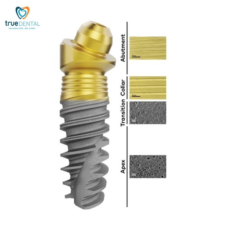 Trụ Implant Nobel của nước nào? Giá bao nhiêu? 2 Cấu tạo của trụ Implant Nobel
