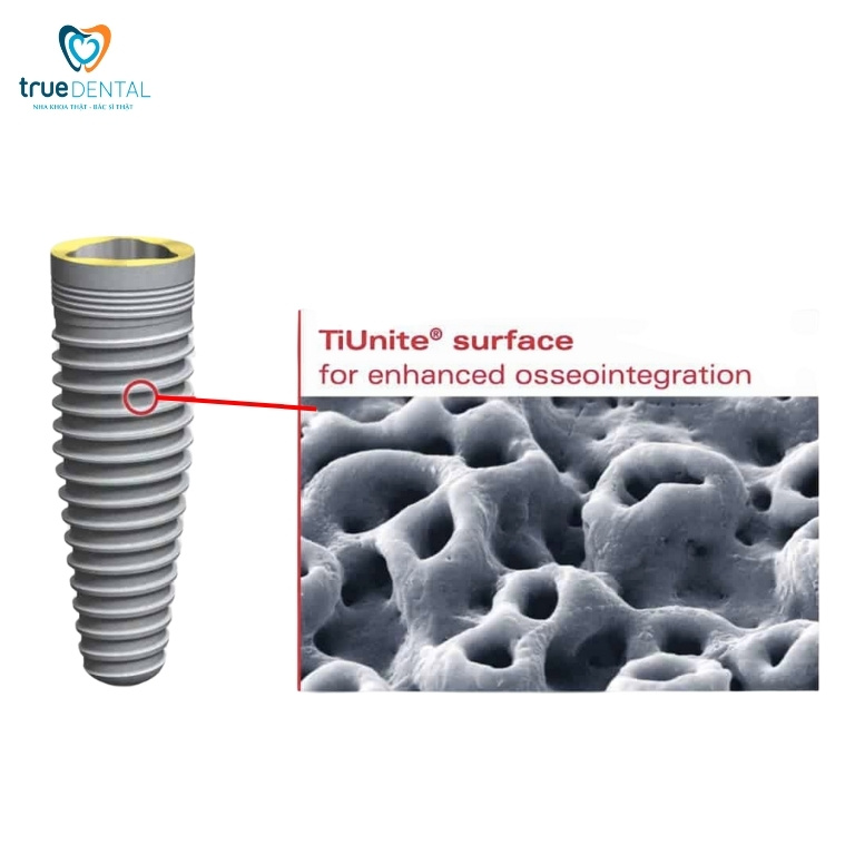 Trụ Implant Nobel của nước nào? Giá bao nhiêu? 3 Công nghệ xử lý bề mặt TiUnite độc quyền