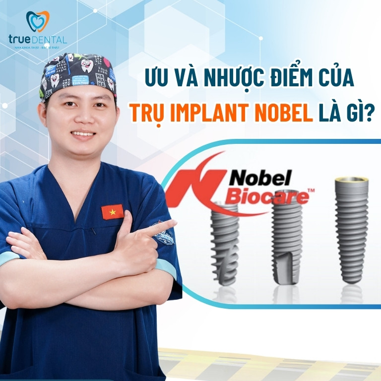 Trụ Implant Nobel của nước nào? Giá bao nhiêu? 4 Ưu và nhược điểm của trụ Implant Nobel Biocare