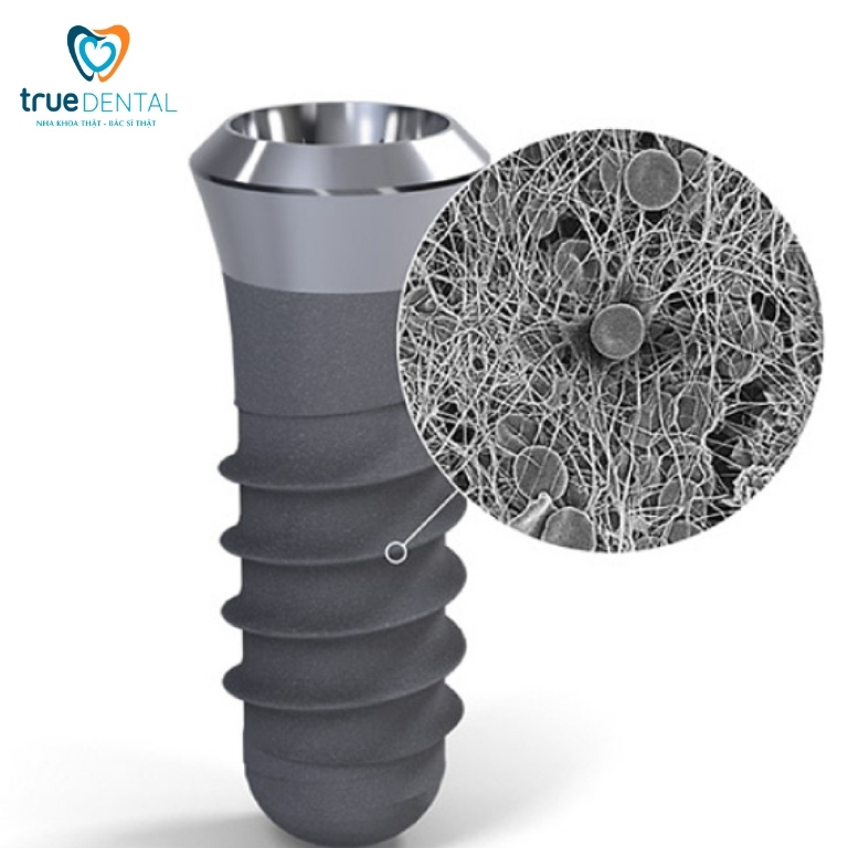 Trụ Implant Straumann: Đặc điểm, xuất xứ và giá thành năm 2025 2 Cấu tạo của trụ Implant Straumann