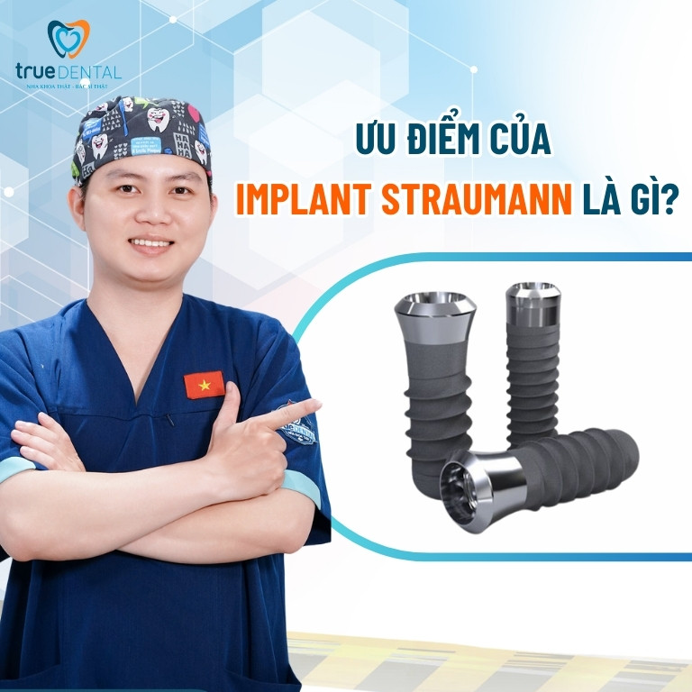 Trụ Implant Straumann: Đặc điểm, xuất xứ và giá thành năm 2025 4 Ưu điểm của trụ Implant Straumann