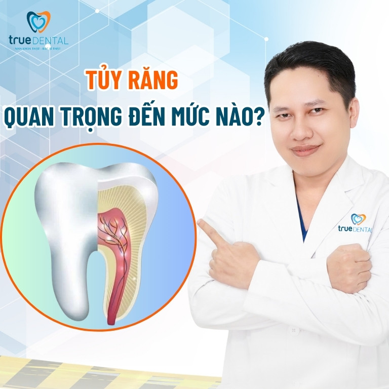 Tủy răng là gì? Cấu tạo, tác dụng và tâm quan trọng của tuỷ răng 3 Tủy răng quan trọng đến mức nào?
