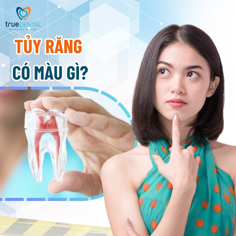 Tủy răng là gì? Cấu tạo, tác dụng và tâm quan trọng của tuỷ răng 5 Tủy răng màu gì?