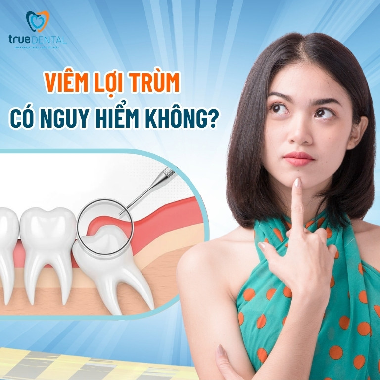 Viêm lợi trùm là gì? Có nguy hiểm không? 4 Viêm lợi trùm có nguy hiểm không?