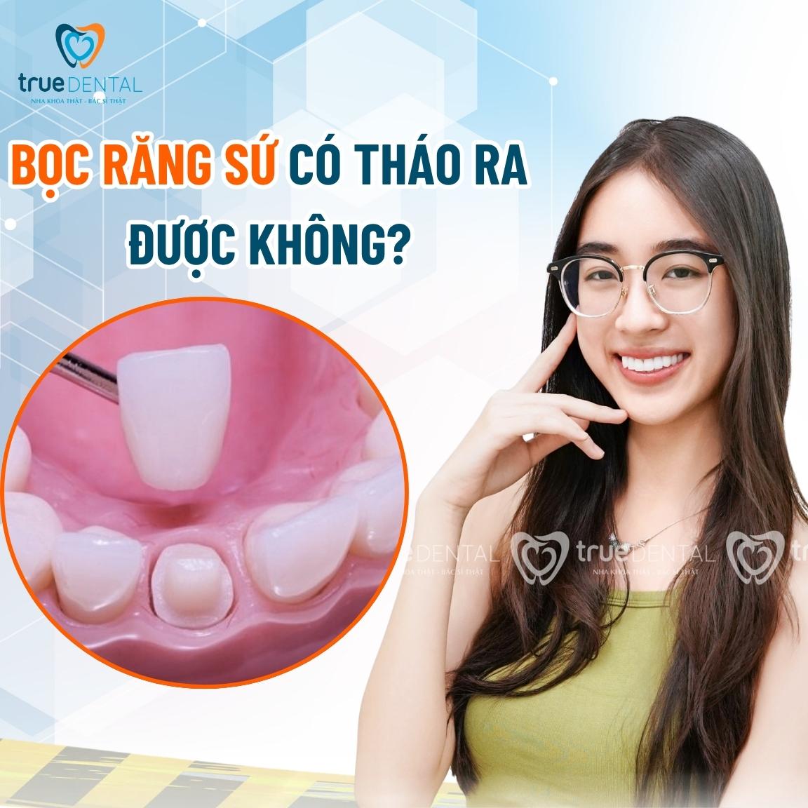 Bọc răng sứ có tháo ra được không? Tháo ra có lắp lại được không? 1 Bọc răng sứ có tháo ra được không?