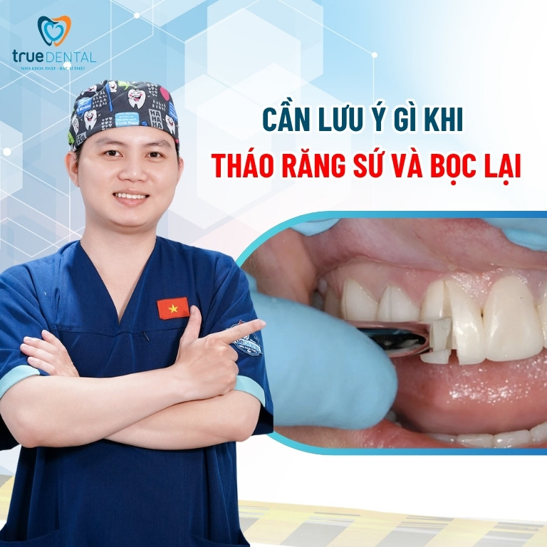 Bọc răng sứ có tháo ra được không? Tháo ra có lắp lại được không? 8 Một số lưu ý khi tháo răng sứ và bọc lại