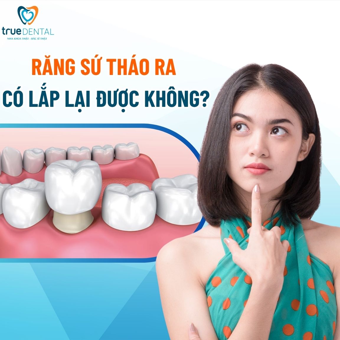 Bọc răng sứ có tháo ra được không? Tháo ra có lắp lại được không? 3 Răng sứ tháo ra có lắp lại được không?