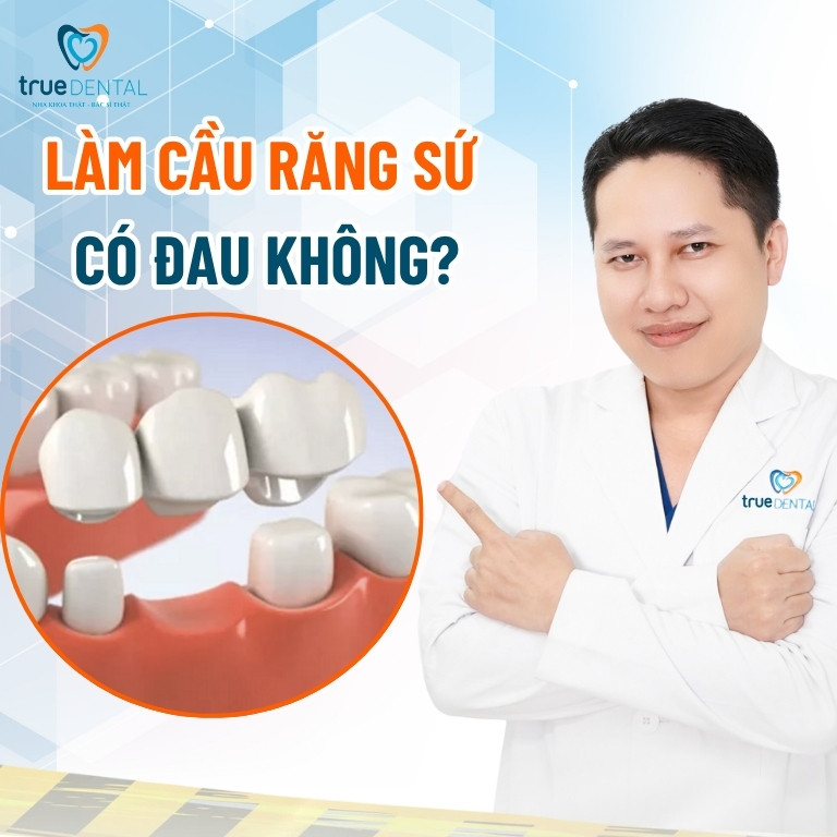 Cầu răng sứ là gì? Làm cầu răng sứ có bền không? 8 Làm cầu răng sứ có đau không?