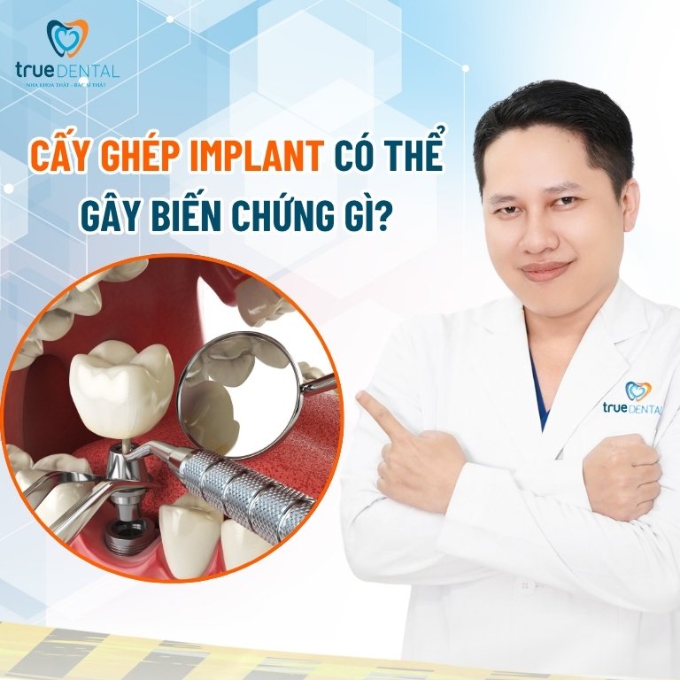 Cấy Ghép Implant Có Tốt Không? Sự Thật Không Phải Ai Cũng Biết 5 6 biến chứng có thể xảy ra khi cấy ghép Implant