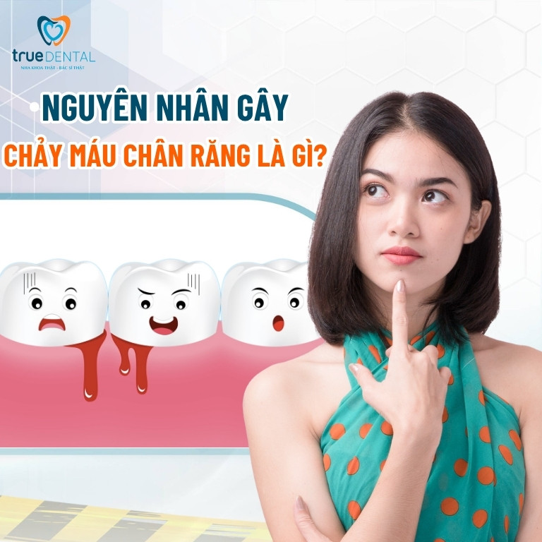 Chảy máu chân răng nguyên nhân do đâu? Chữa bằng cách nào? 2 Nguyên nhân chảy máu chân răng