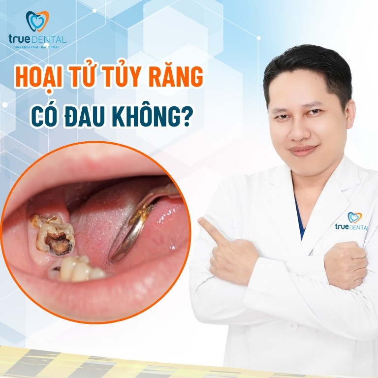 Hoại tử tủy răng: Nguyên nhân, dấu hiệu và cách điều trị 8 Hoại tử tủy răng có đau không?