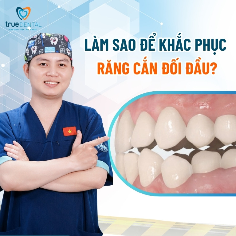 Thế nào là khớp cắn đối đầu? Điều trị bằng cách nào? 4 Làm sao để khắc phục tình trạng răng cắn đối đầu?
