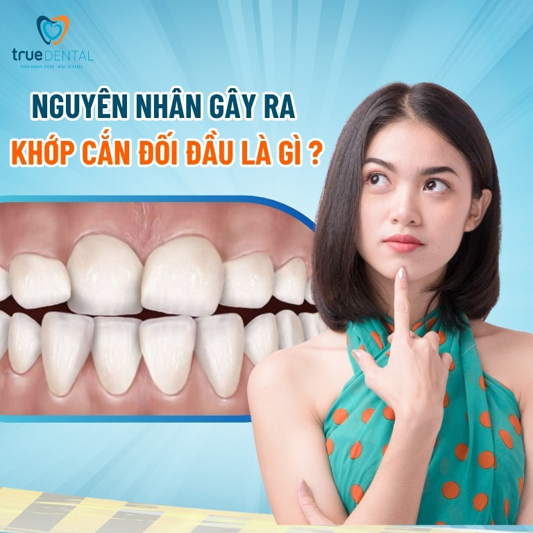 Thế nào là khớp cắn đối đầu? Điều trị bằng cách nào? 2 Nguyên nhân gây ra khớp cắn đối đầu là gì?