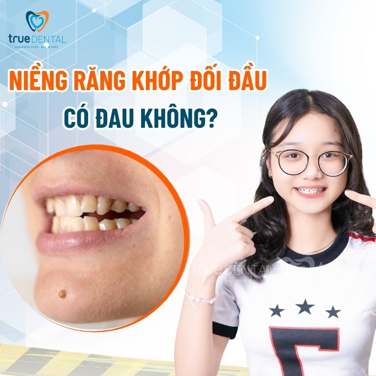 Thế nào là khớp cắn đối đầu? Điều trị bằng cách nào? 8 Niềng răng khớp đối đầu có đau không?