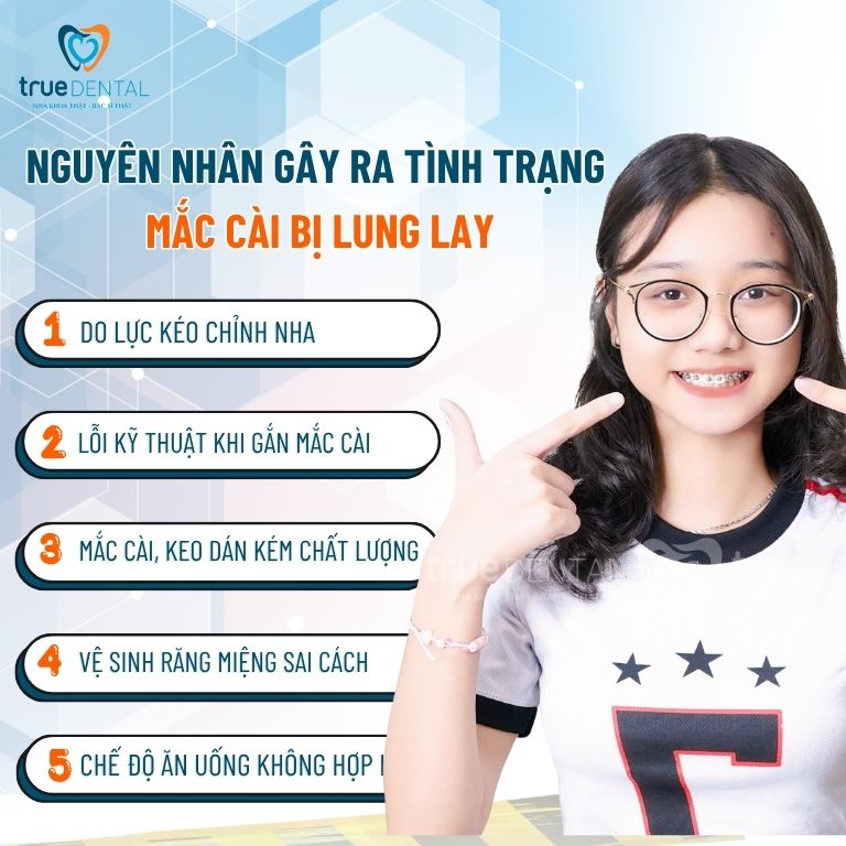 Mắc Cài Bị Lung Lay: Dấu Hiệu Cảnh Báo Bạn Không Nên Bỏ Qua! 1 Nguyên nhân gây ra tình trạng mắc cài bị lung lay