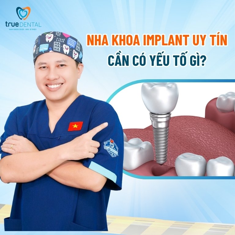 Nha Khoa Implant Uy Tín: Cách Đánh Giá Và Tránh 'Bẫy' Quảng Cáo 1 Yếu tố cần có của một địa chỉ nha khoa Implant uy tín