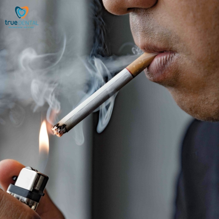 Răng có vết đen: Nguyên nhân, cách chữa trị và phòng ngừa 4 Do hút thuốc lá