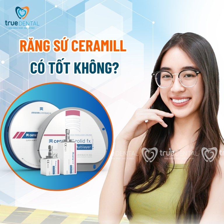 Răng sứ Ceramill có tốt không? Giá bao nhiêu? 5 Răng sứ Ceramill có tốt không?