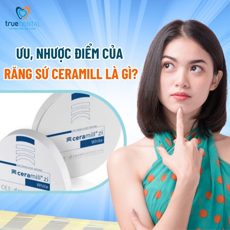 Răng sứ Ceramill có tốt không? Giá bao nhiêu? 4 Ưu, nhược điểm của răng sứ Ceramill