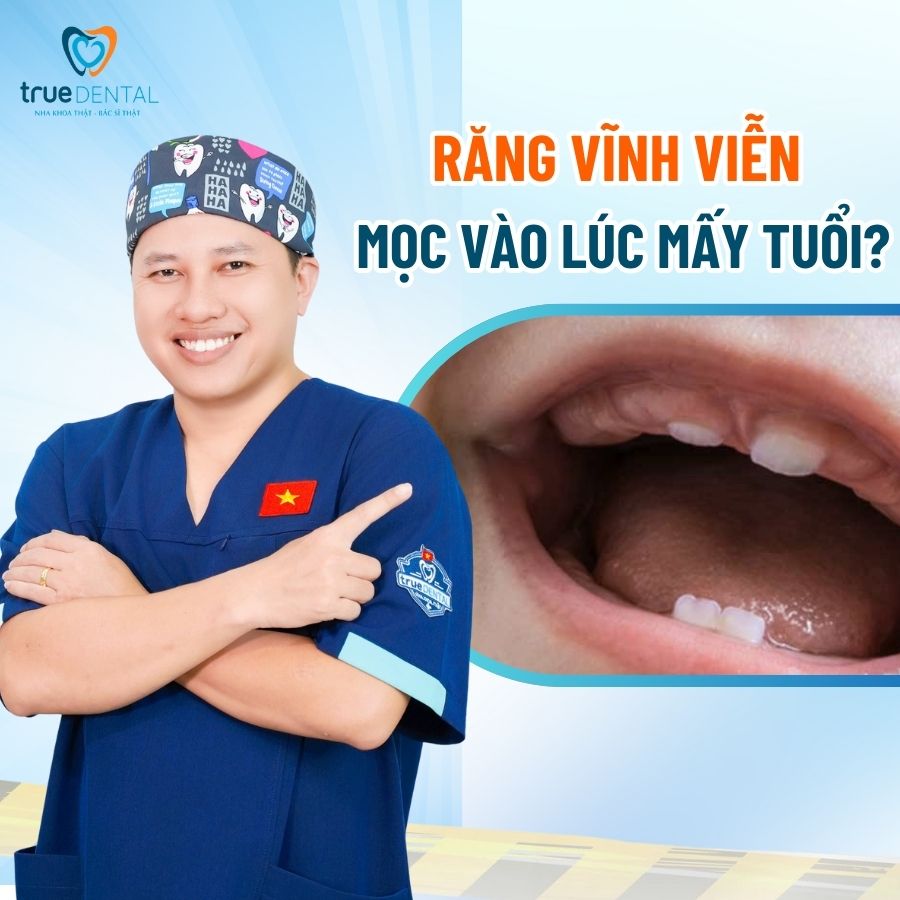 Răng vĩnh viễn là răng nào? Có bao nhiêu cái? 5 Răng vĩnh viễn mọc vào lúc mấy tuổi?