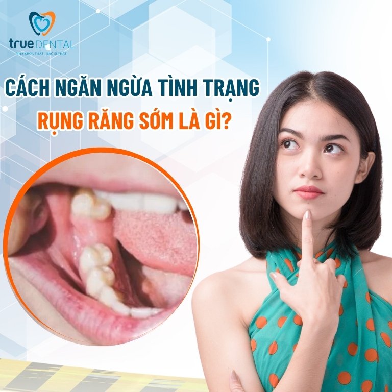 Rụng răng sớm: Nguyên nhân, tác hại và cách điều trị 8 Cách ngăn ngừa tình trạng rụng răng sớm