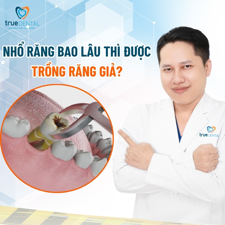 Trồng răng giả mất bao lâu để hoàn thành? 5 Nhổ răng bao lâu thì có thể trồng được răng giả?