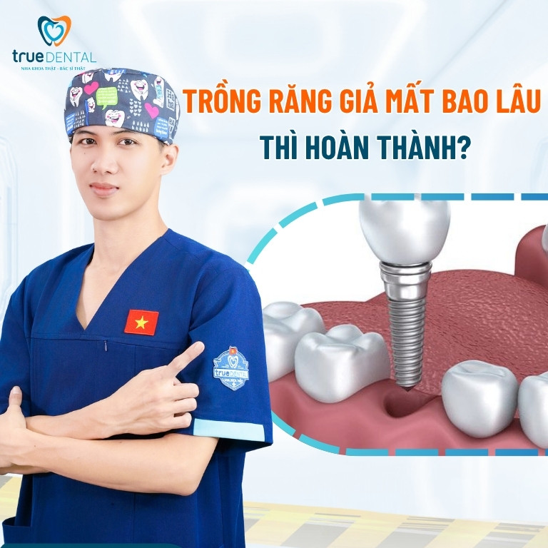 Trồng răng giả mất bao lâu để hoàn thành? 6 Trồng răng giả mất bao lâu thì hoàn thành?
