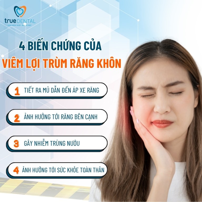 Viêm lợi răng khôn có tự khỏi không? Điều trị như thế nào? 4 4 biến chứng của viêm lợi trùm răng khôn