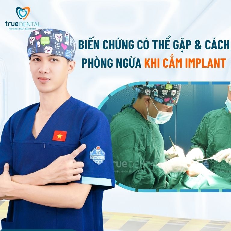 Biến Chứng Có Thể Gặp & Cách Phòng Ngừa Khi Cắm Implant