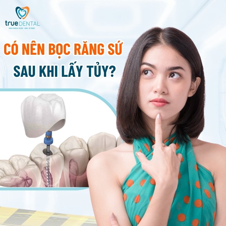 Có nên bọc răng sứ sau khi lấy tủy? 1 Có nên bọc răng sứ sau khi lấy tủy?