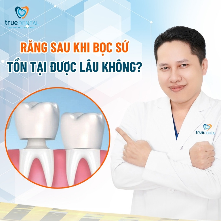 Có nên bọc răng sứ sau khi lấy tủy? 5 Răng sau khi bọc sứ thì có tồn tại được lâu không?