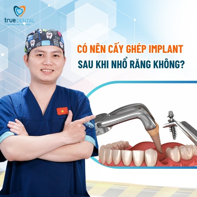 Có nên cấy ghép Implant sau khi nhổ răng? 2 Có nên cấy ghép Implant sau khi nhổ răng không?