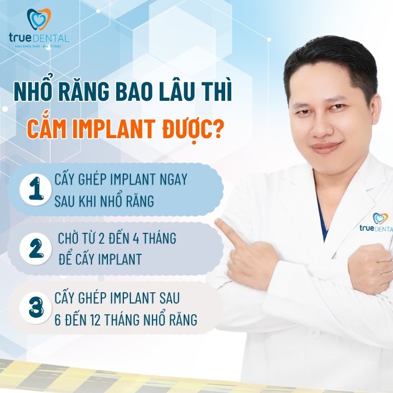 Có nên cấy ghép Implant sau khi nhổ răng? 3 Nhổ răng bao lâu thì cắm Implant được?