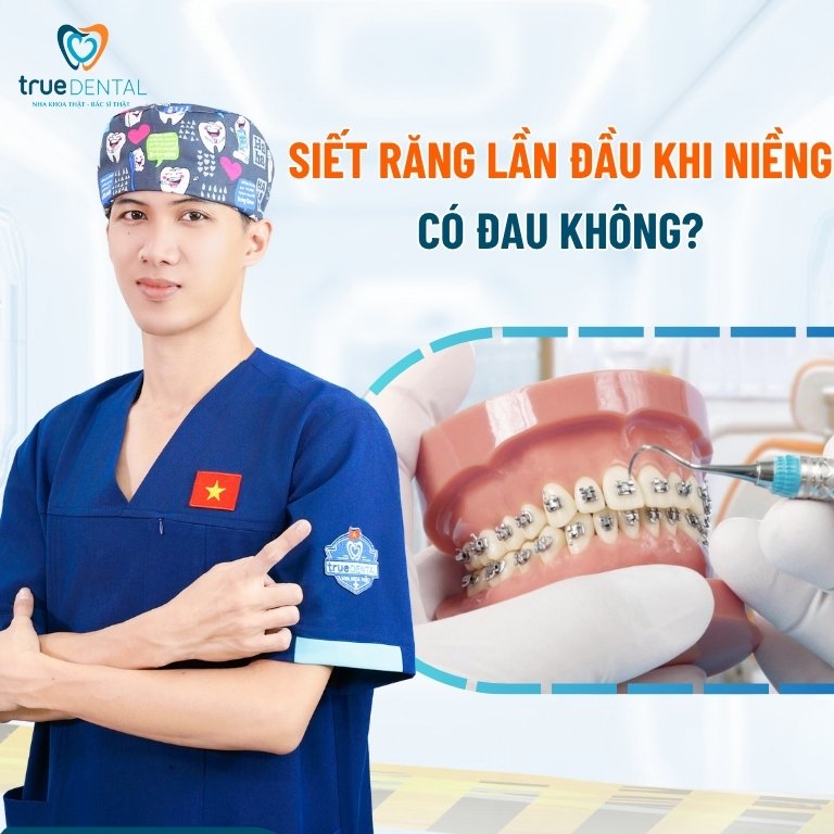 Gắn mắc cài bao lâu thì nên thực hiện siết răng? 9 Siết răng lần đầu khi niềng có đau không?