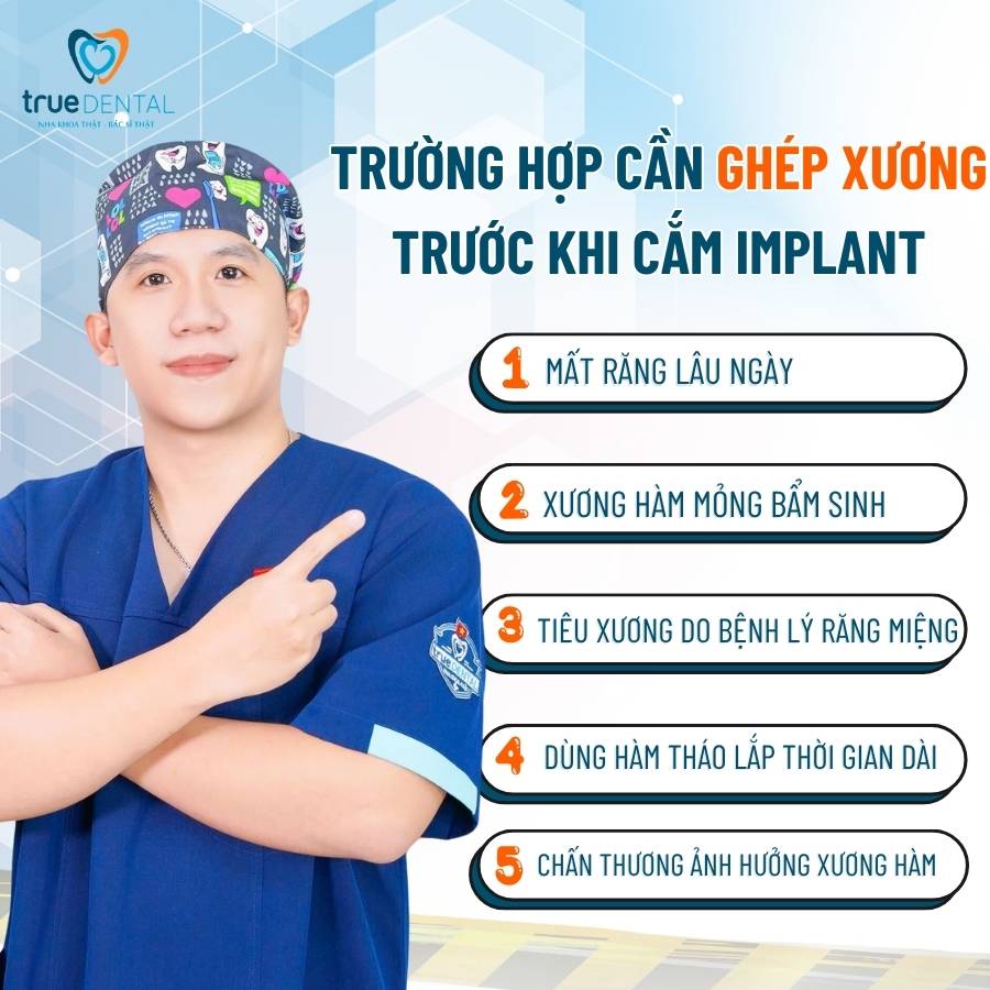 Ghép Xương Implant Là Gì? Có Đau Không? Chi Phí Bao Nhiêu? 2 Trường hợp cần ghép xương răng trước khi cắm Implant
