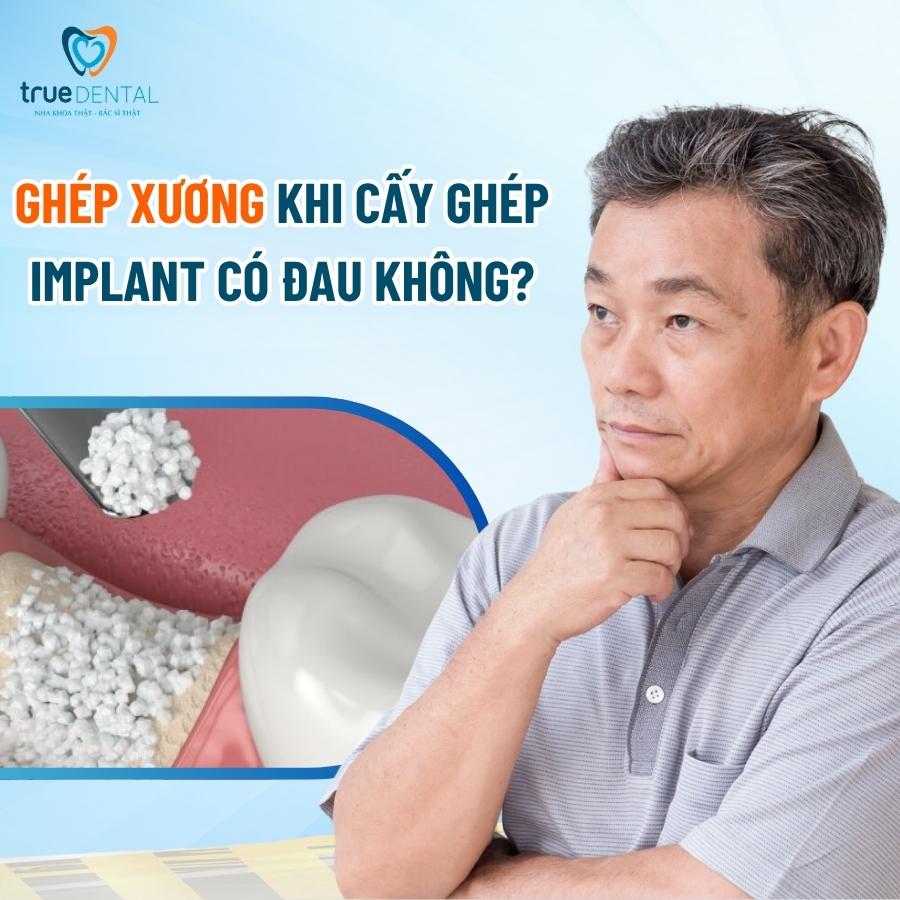 Ghép Xương Implant Là Gì? Có Đau Không? Chi Phí Bao Nhiêu? 6 Ghép xương khi cấy ghép Implant có đau không?