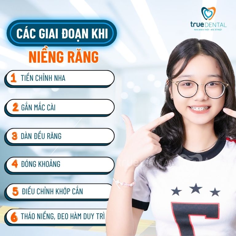 Giai đoạn nào là xấu nhất sau khi niềng răng? 1 Tổng quan các giai đoạn khi niềng răng
