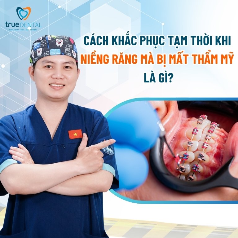 Giai đoạn nào là xấu nhất sau khi niềng răng? 3 Cách khắc phục tạm thời sau khi niềng răng mà bị mất thẩm mỹ