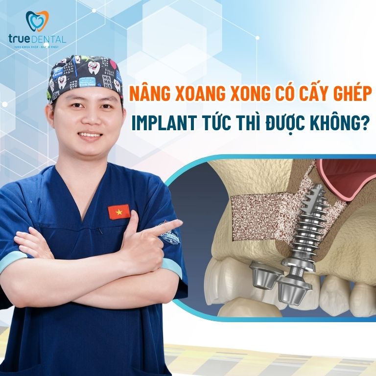 Kỹ thuật nâng xoang hàm trong cấy ghép răng Implant 8 Nâng xoang xong có cấy ghép Implant tức thì được không?