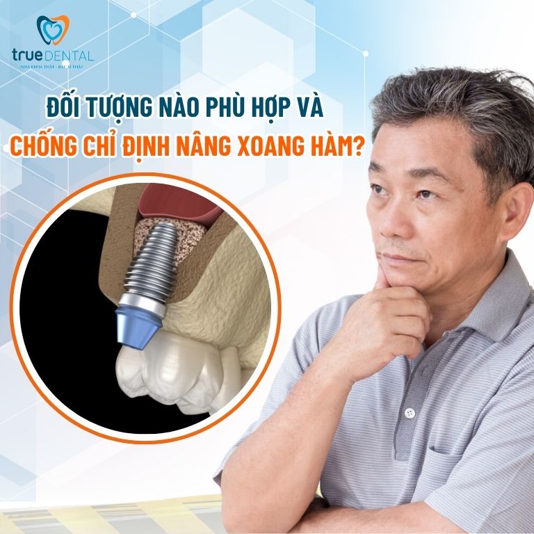 Kỹ thuật nâng xoang hàm trong cấy ghép răng Implant 5 Đối tượng phù hợp và chống chỉ định nâng xoang hàm