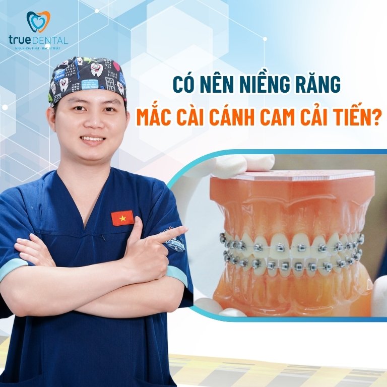 Giải Mã Mắc Cài Cánh Cam Cải Tiến: Có Nên Niềng Không? 4 Có nên niềng răng mắc cài cánh cam cải tiến không?