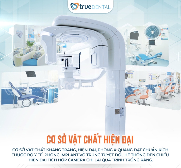 Nha khoa cấy ghép Implant tại TPHCM đáng tin cậy 4 True Dental – Địa chỉ cấy ghép Implant uy tín tại TPHCM