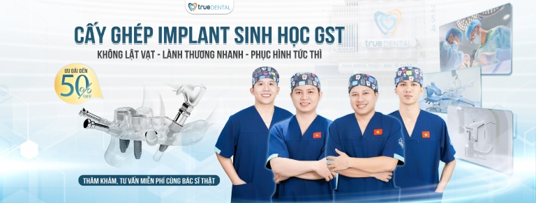 Nha khoa cấy ghép Implant tại TPHCM đáng tin cậy 2 True Dental – Địa chỉ cấy ghép Implant uy tín tại TPHCM