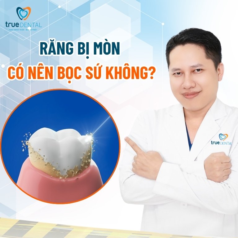 Răng bị mòn có nên bọc sứ? 2 Răng bị mòn có nên bọc sứ không?