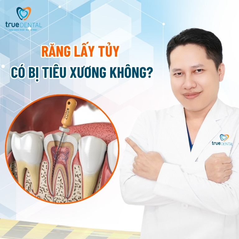 Răng lấy tủy có bị tiêu xương không? 3 Răng lấy tủy có bị tiêu xương không?
