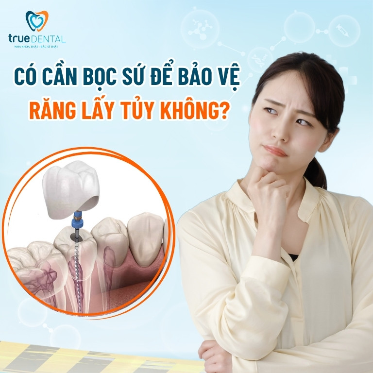 Răng lấy tủy có tồn tại được hết đời 5 bọc sứ thì răng lấy tuỷ có tồn tại hết đời không?